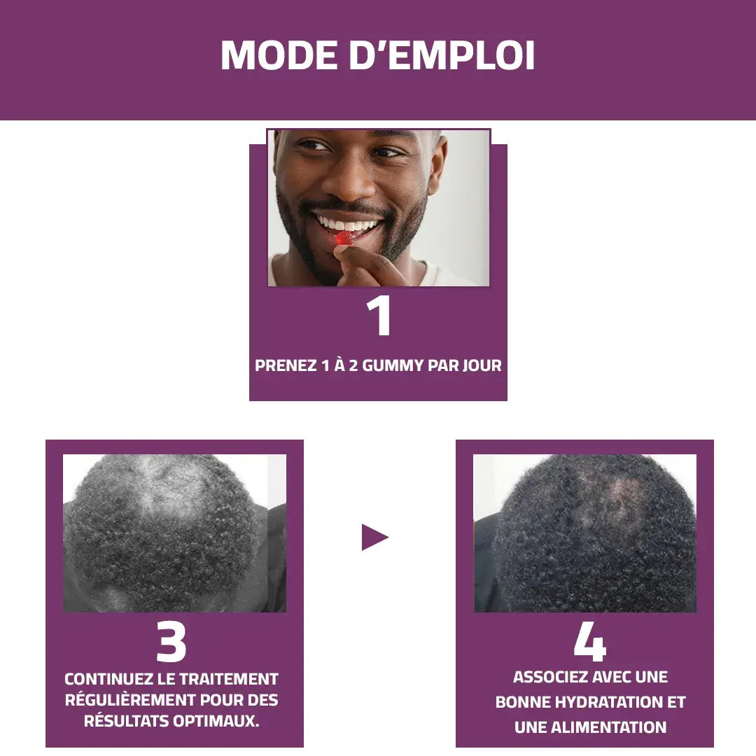 Gummies Vitaminées à la Biotine – Pour des Cheveux Forts, Épais et Brillants