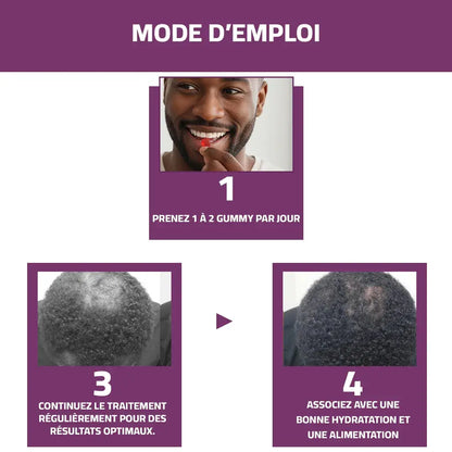 Gummies Vitaminées à la Biotine – Pour des Cheveux Forts, Épais et Brillants